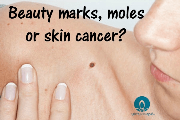 Beauty Marks, Moles or Skin Cancer? - A Girl's Gotta Spa!